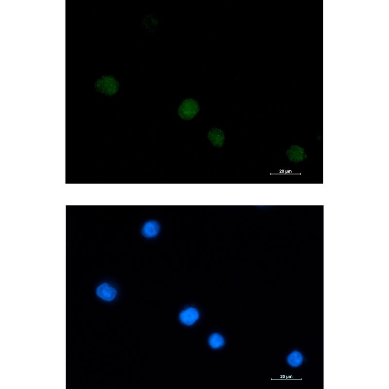 LGALS14 Rabbit mAb