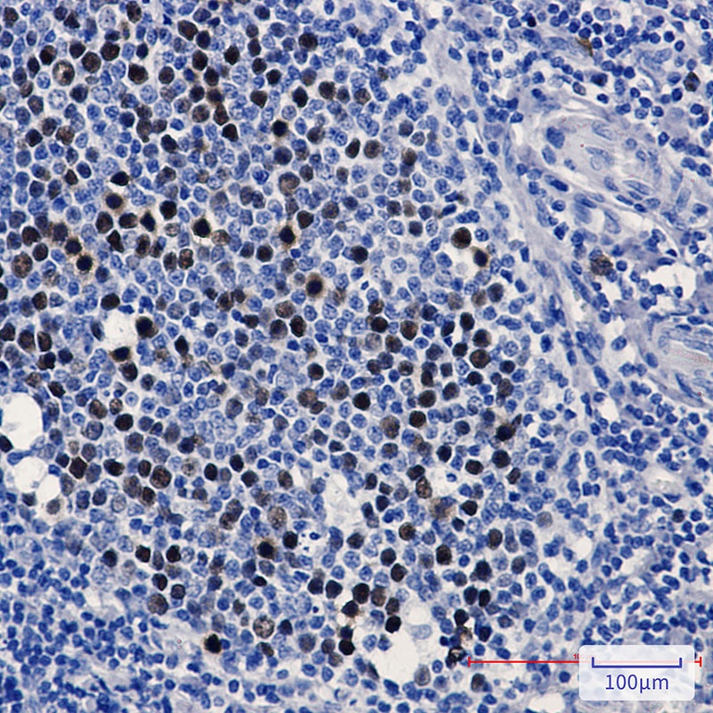 KIFC1 Rabbit mAb