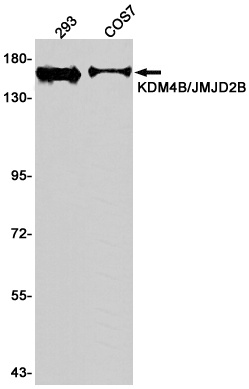 KDM4B Antibody
