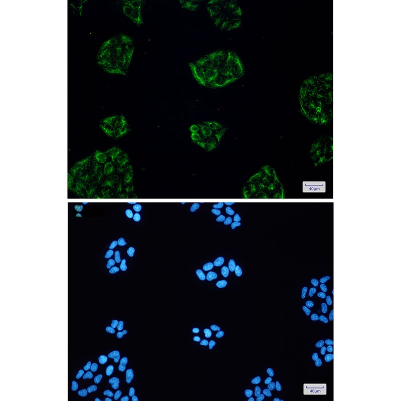 KCTD9 Rabbit mAb