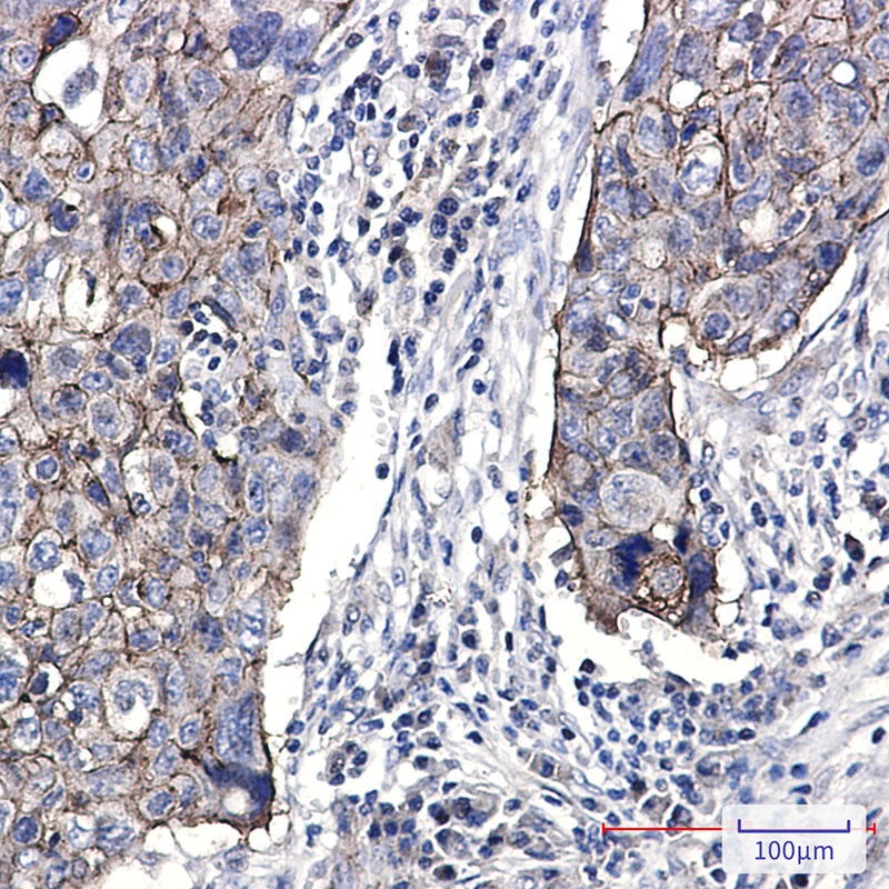 Junctional Adhesion Molecule 1 Rabbit mAb