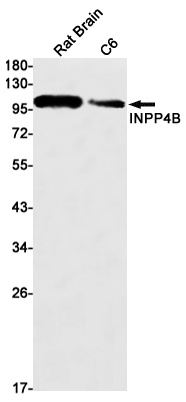 INPP4B Rabbit mAb