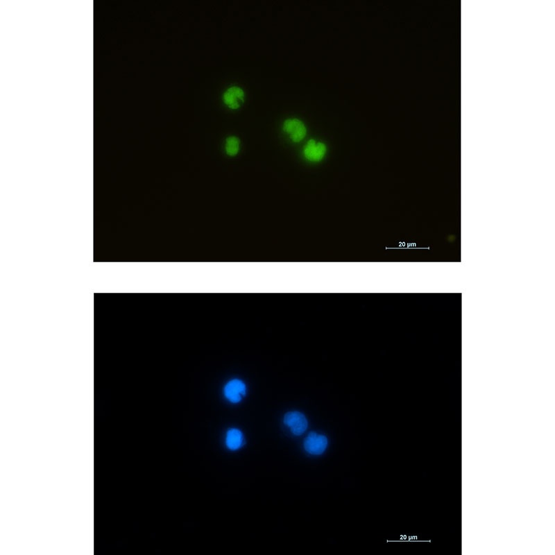 ILF3 Rabbit mAb