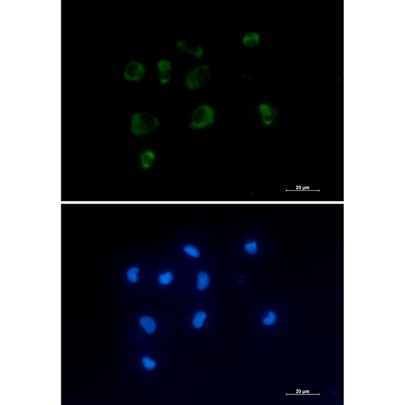 IL1RN Antibody