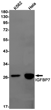 [KD] IGFBP7 Rabbit mAb