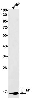 IFITM1 Rabbit mAb
