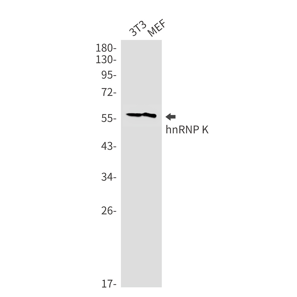 hnRNP K Rabbit mAb