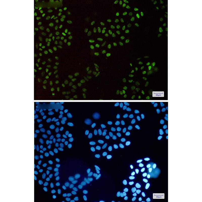 HLTF Rabbit mAb