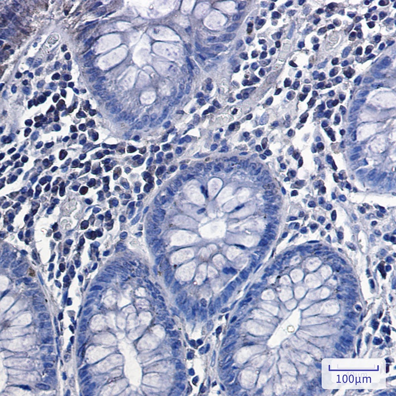 Phospho-Glycogen synthase (Ser641) Rabbit mAb