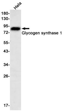 Glycogen Synthase 1 Rabbit mAb