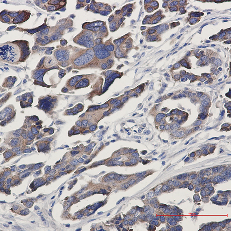GFPT1 Rabbit mAb