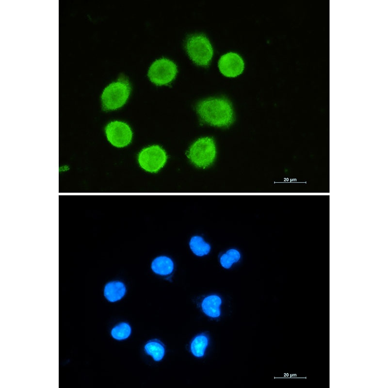 GAP43 Rabbit mAb