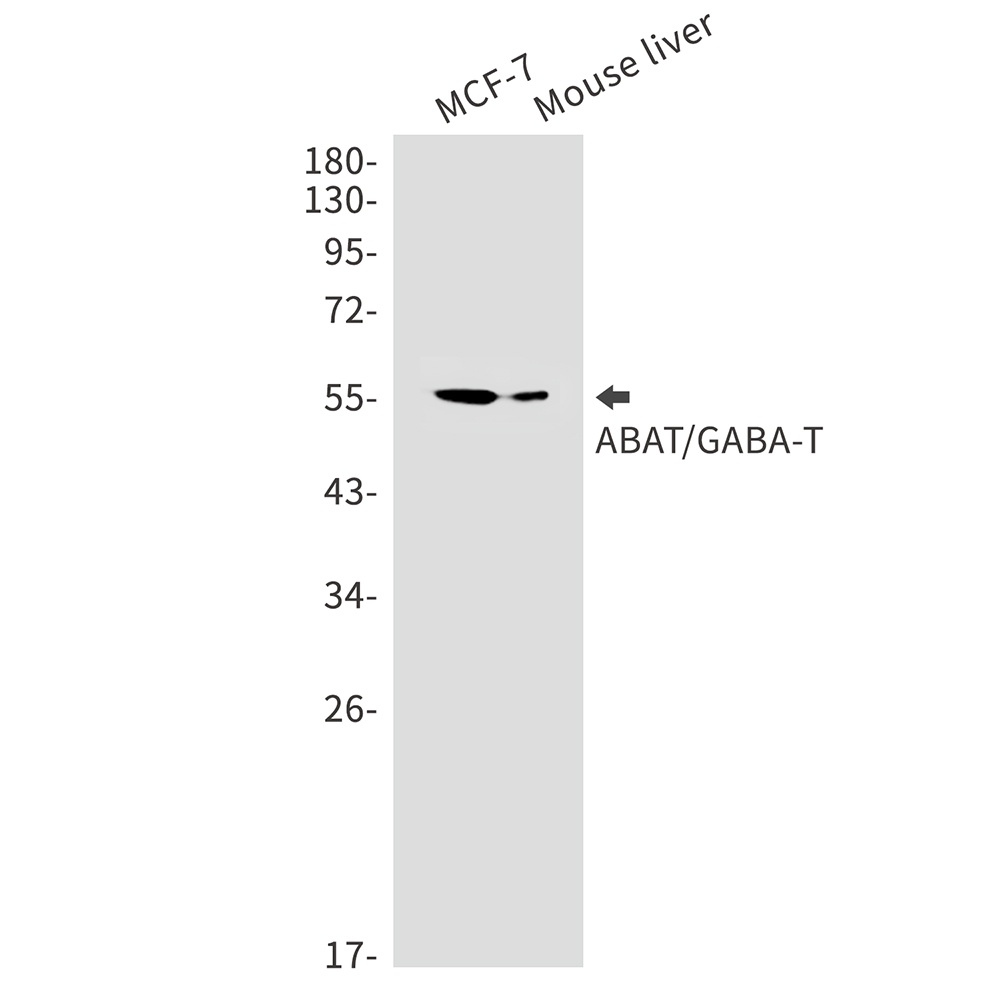 ABAT Rabbit mAb