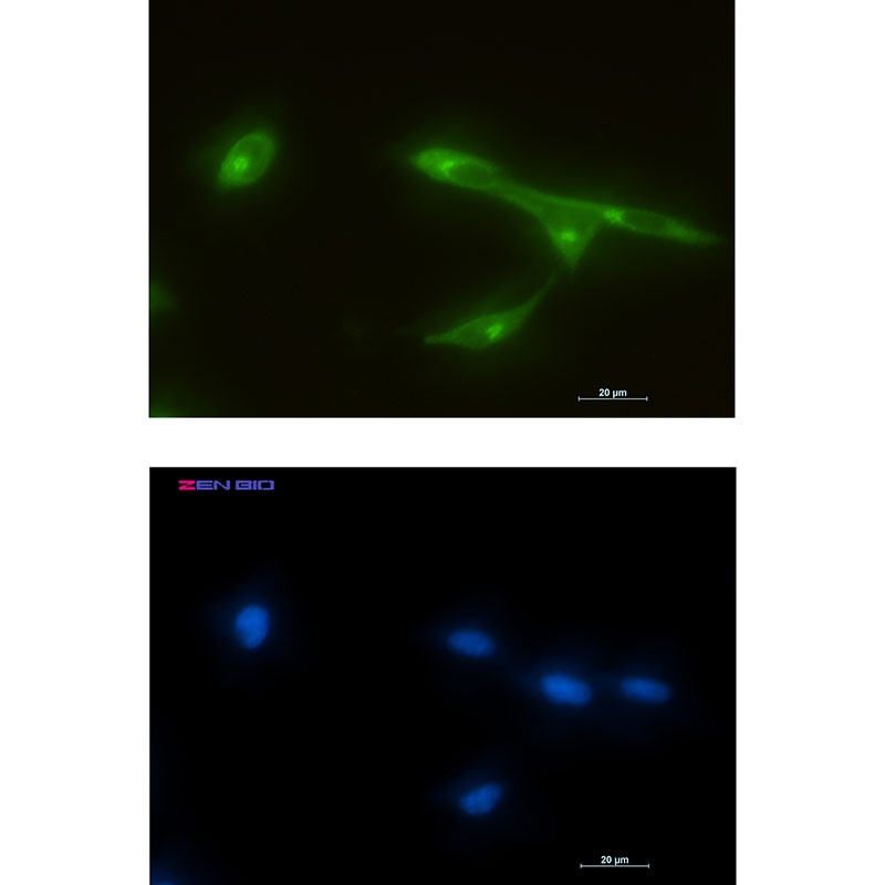 FRAT1 Rabbit mAb