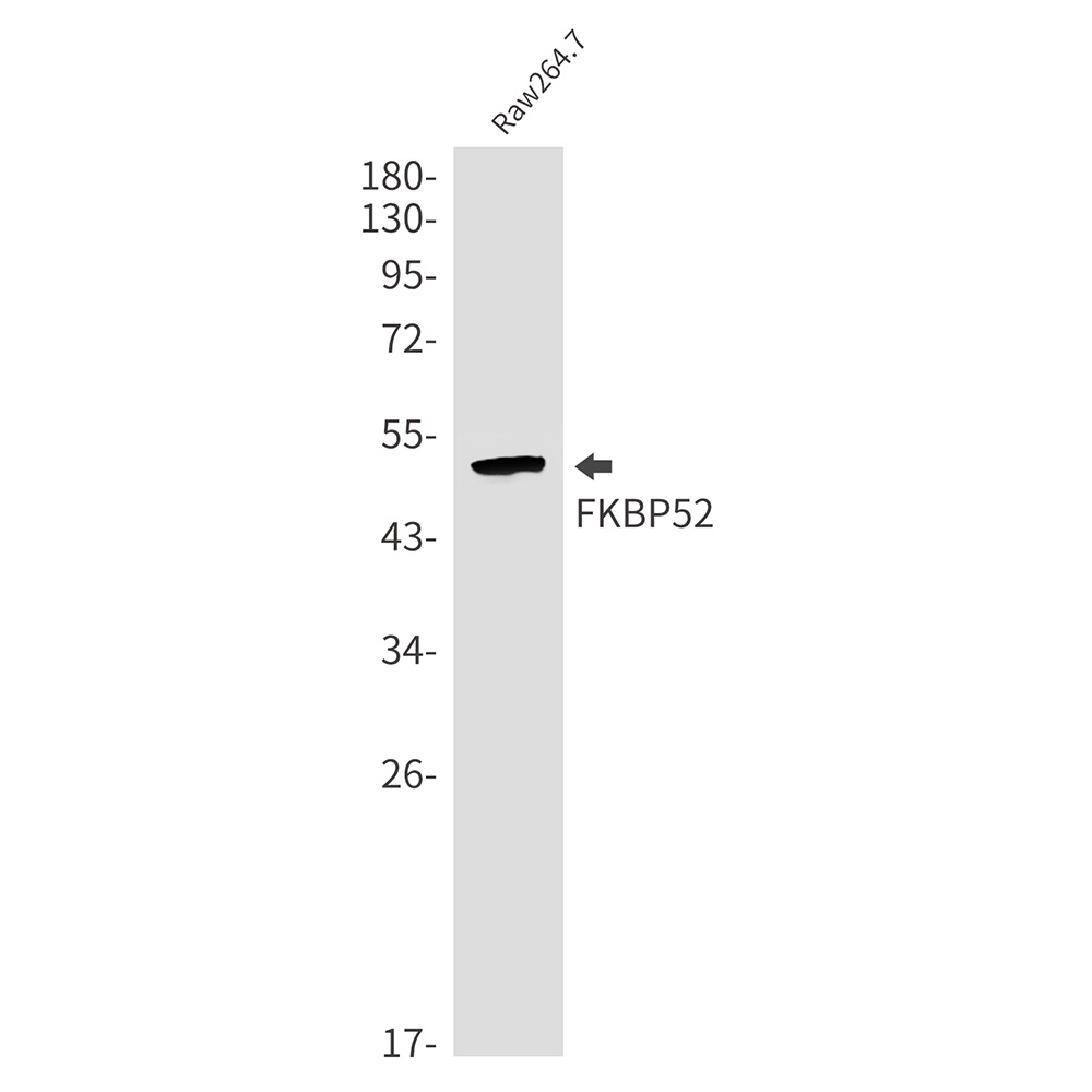 FKBP52 Rabbit mAb