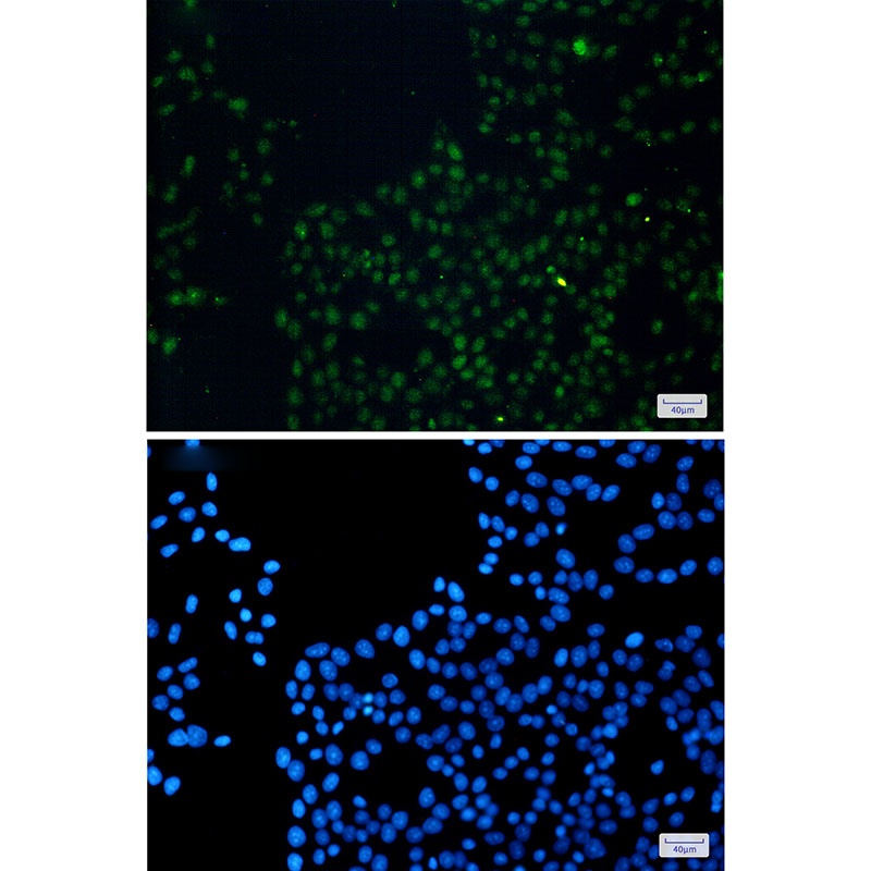 FAM98B Rabbit mAb