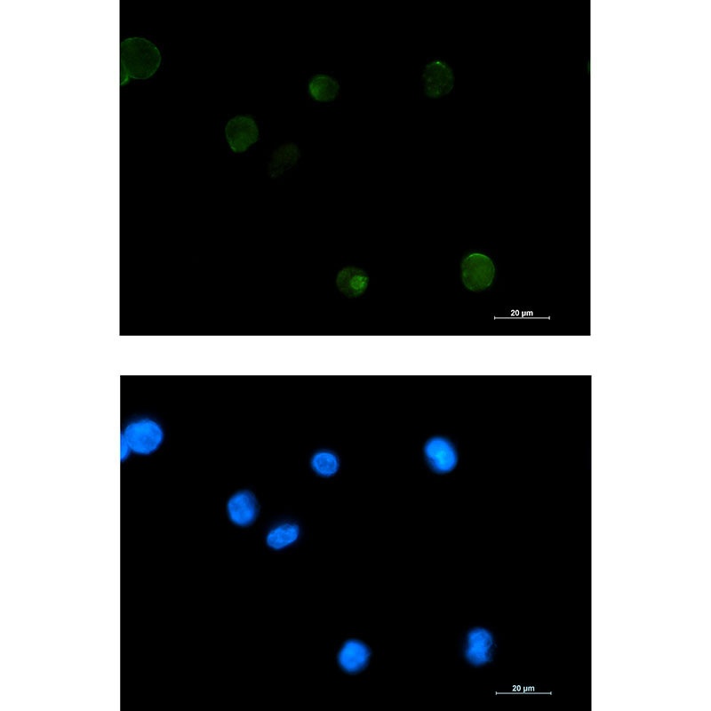 Extracellular Matrix Protein 1 Rabbit mAb