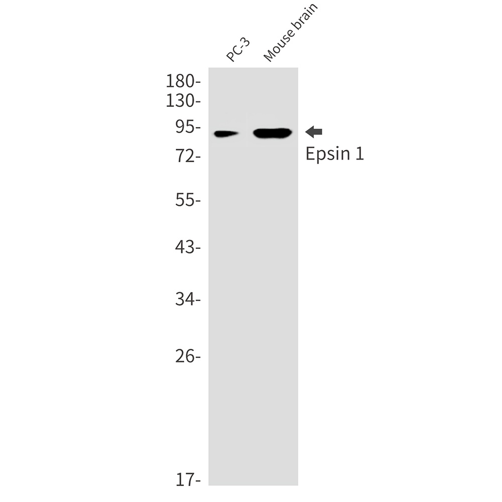 Epsin 1 Rabbit mAb