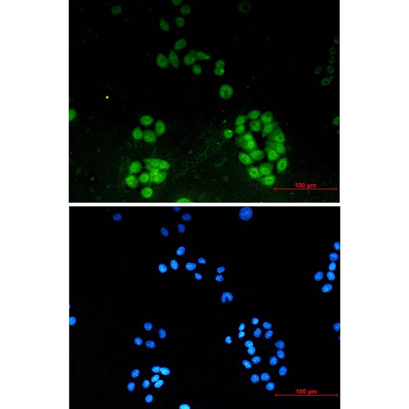ENT2 Rabbit mAb