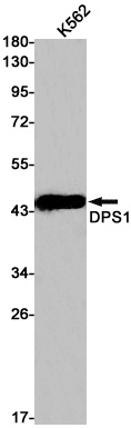 PDSS1 Antibody