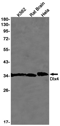 DLX4 Rabbit mAb