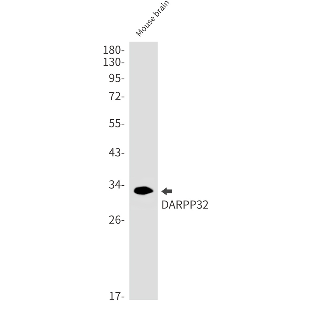 [KD] DARPP32 Rabbit mAb