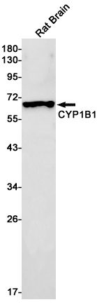 Cytochrome P450 1B1 Rabbit mAb