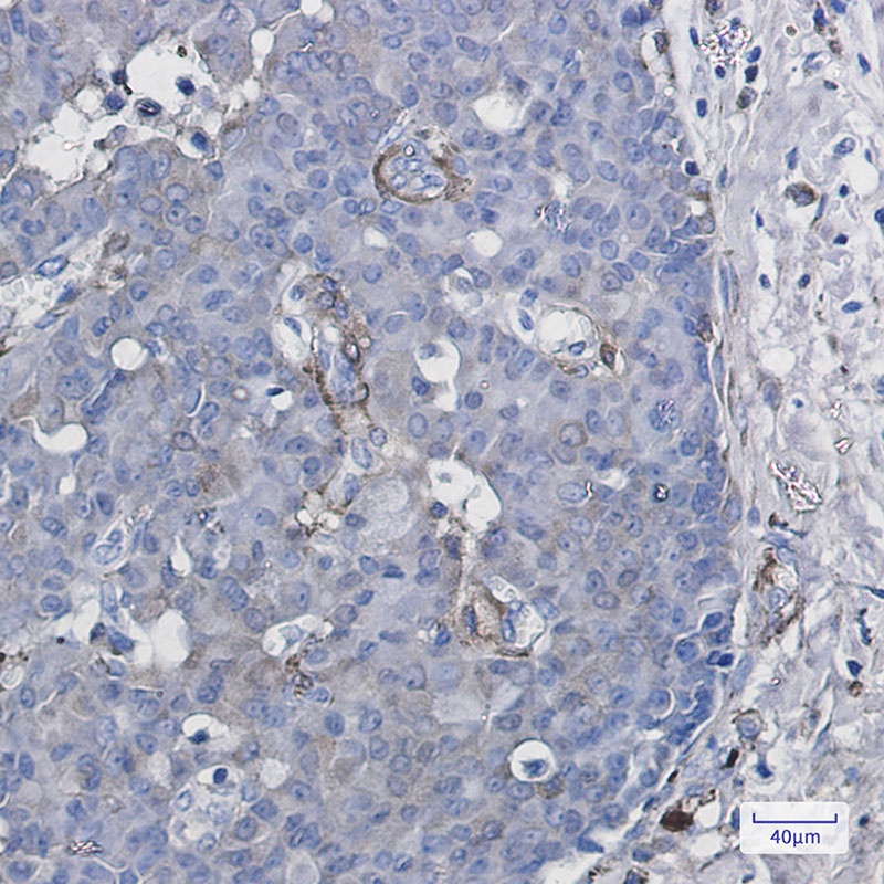 Cytochrome P450 1B1 Rabbit mAb