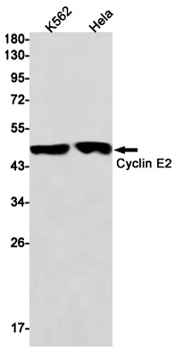 [KO] Cyclin E2 Rabbit mAb