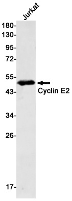Cyclin E2 Rabbit mAb