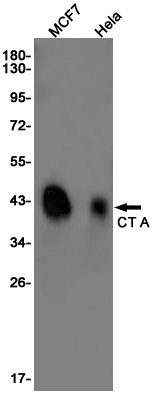 CT A Rabbit mAb