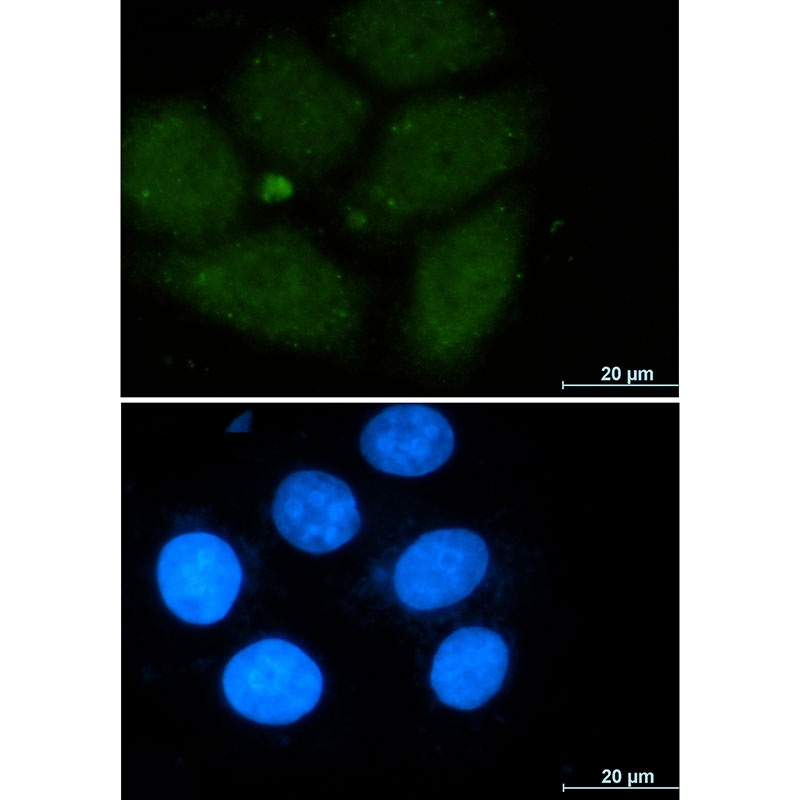 CRM1 Rabbit mAb