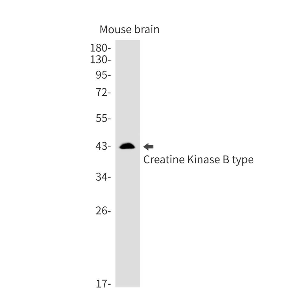[KD] Creatine Kinase B type Rabbit mAb