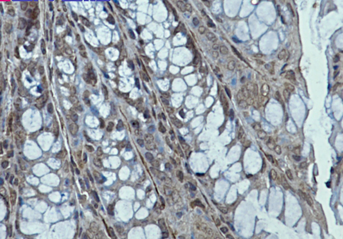 [KD] Creatine Kinase B type Rabbit mAb