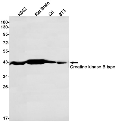 [KD] Creatine Kinase B type Rabbit mAb