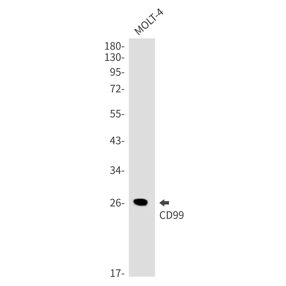 CD99 Rabbit mAb