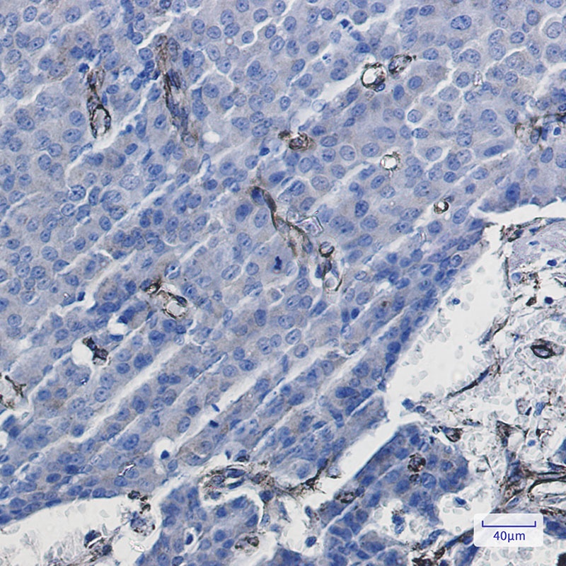 Caveolin 1 Rabbit mAb