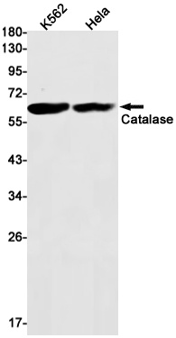 [KO] Catalase Rabbit mAb