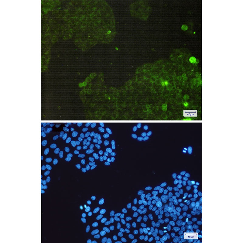 [KO] Catalase Rabbit mAb