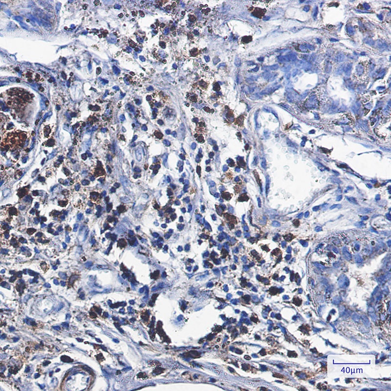 [KO] Catalase Rabbit mAb