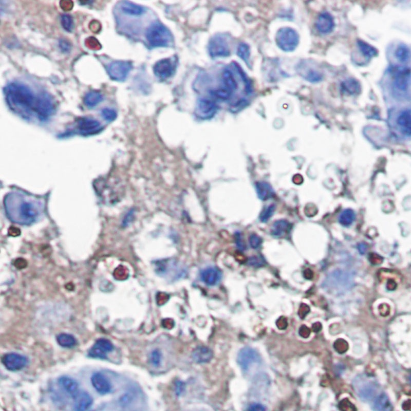 [KO] Catalase Rabbit mAb
