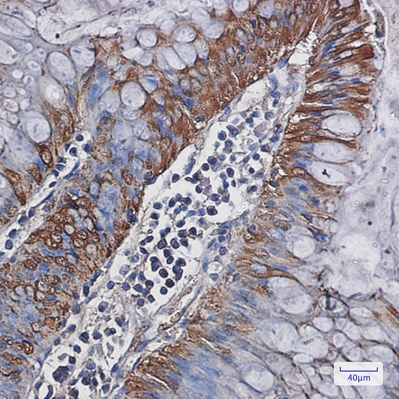 Carbonic Anhydrase 1 Rabbit mAb
