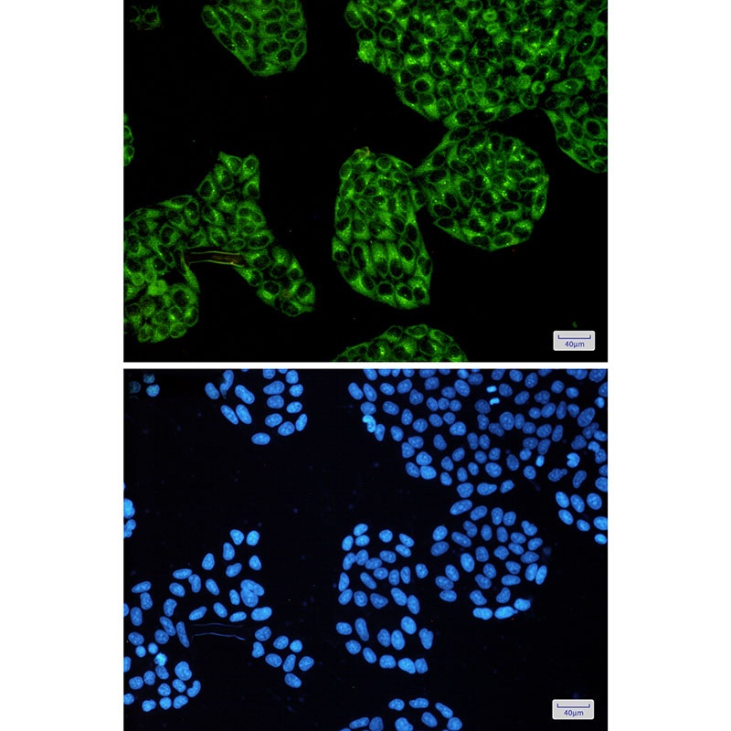[KD] cAMP Protein Kinase Catalytic Subunit Rabbit mAb
