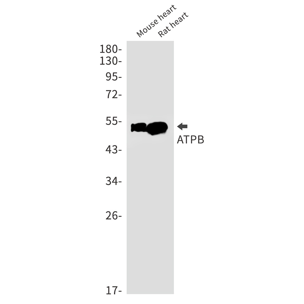 ATP5F1B Antibody