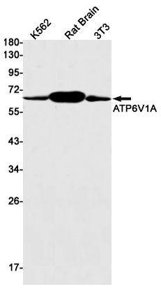 ATP6V1A Rabbit mAb
