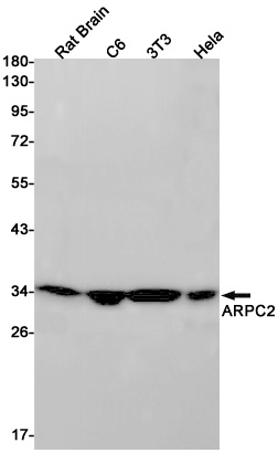 ARPC2 Antibody