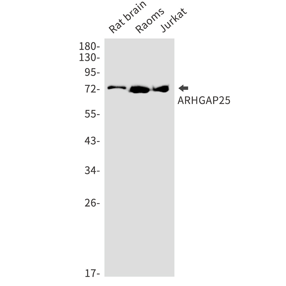 ARHGAP25 Antibody