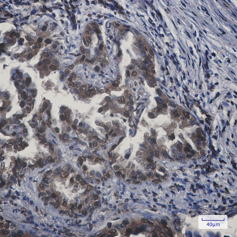 APPL Rabbit mAb