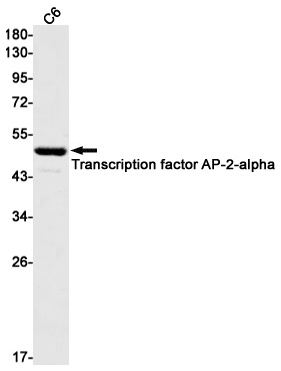 AP2 alpha Rabbit mAb