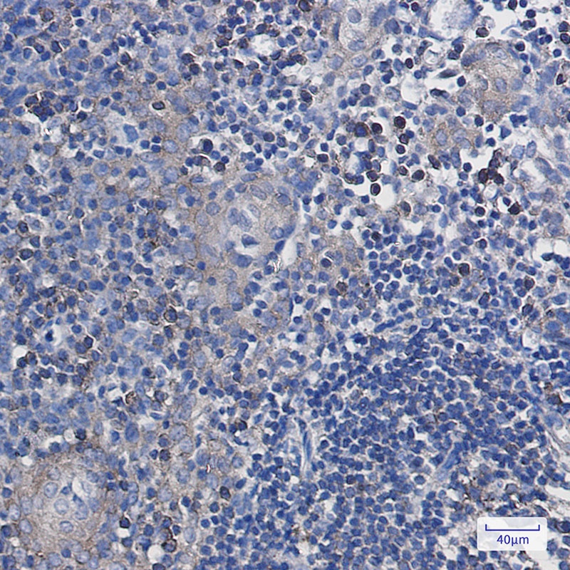 Annexin VII Rabbit mAb